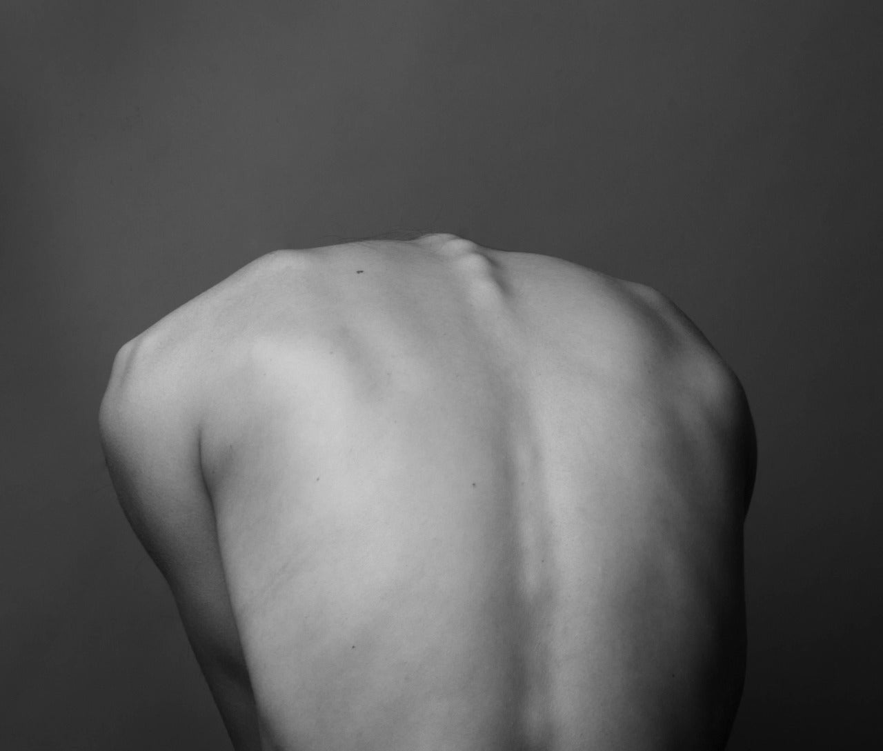 Image of a person with a curved back