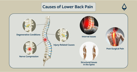 A visual aid to understand the most common causes of lower back pain, from injury-related causes to lifestyle factors.
