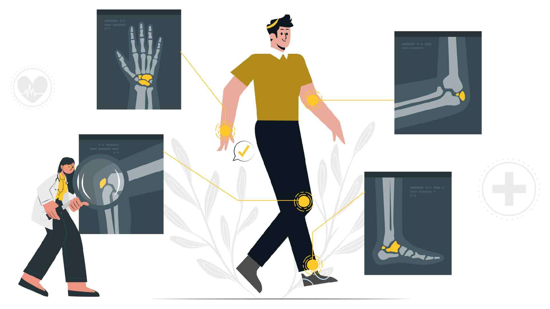 What is Rheumatoid Arthritis?