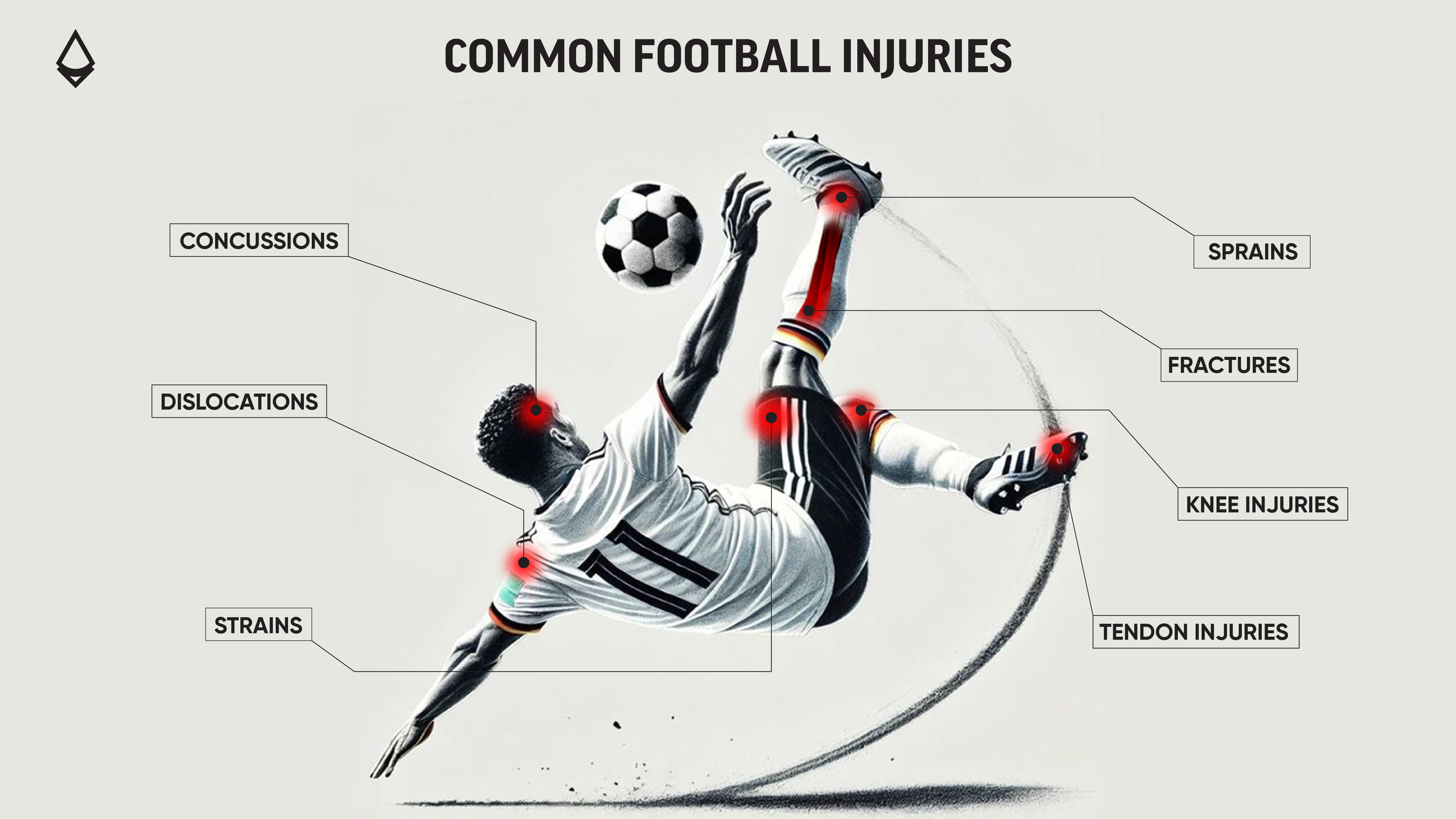 Common Football Injuries