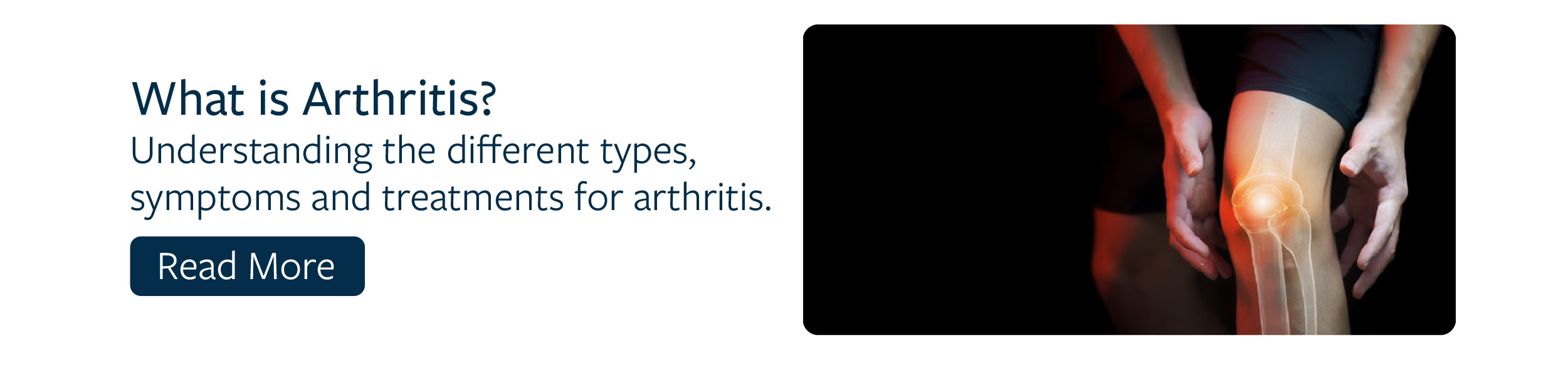 The Savikalpa Journal Blog 1 - What is Arthritis?