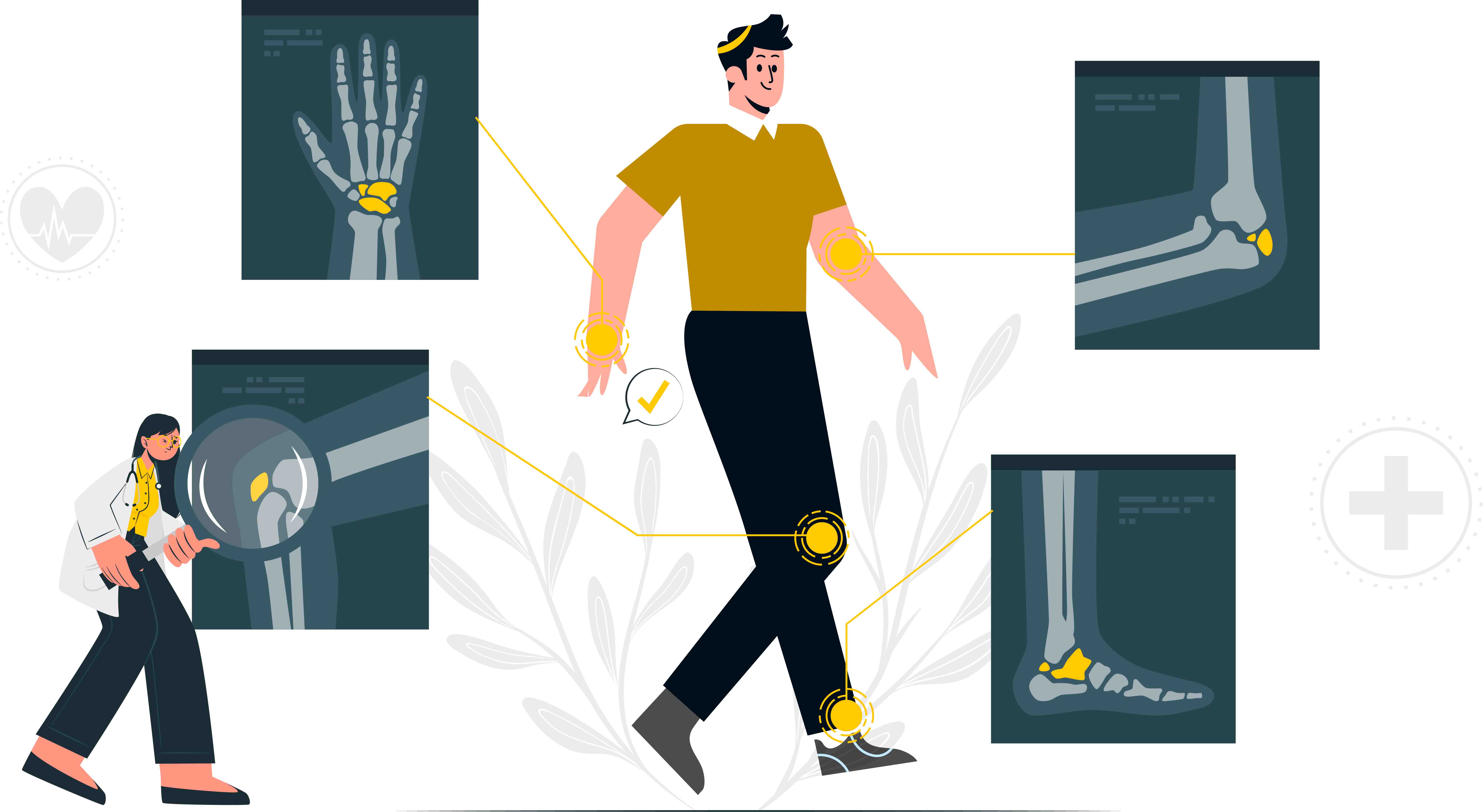 Early Signs of Arthritis: How to Detect and Prevent Progression