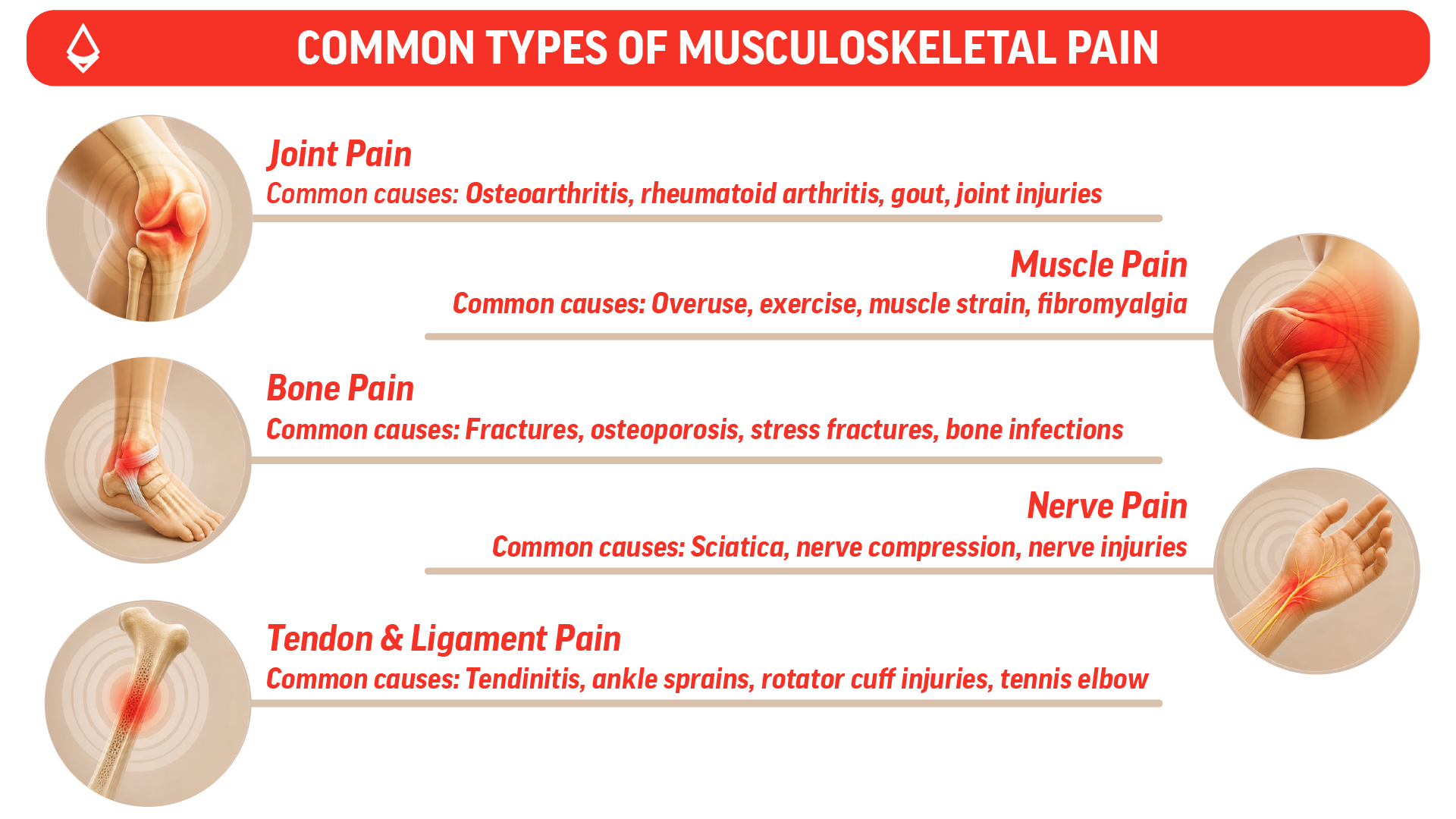 An infographic showing the common types of musculoskeletal pain depicted through icons with copy alongside.