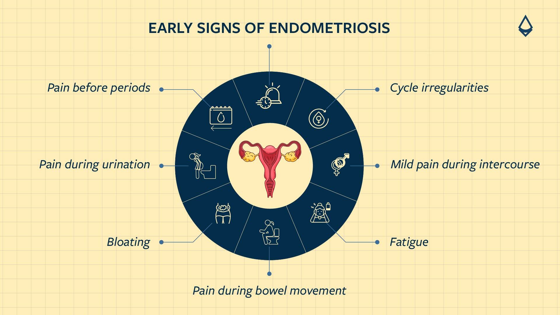 An infographic showing early signs of endometriosis in a circle