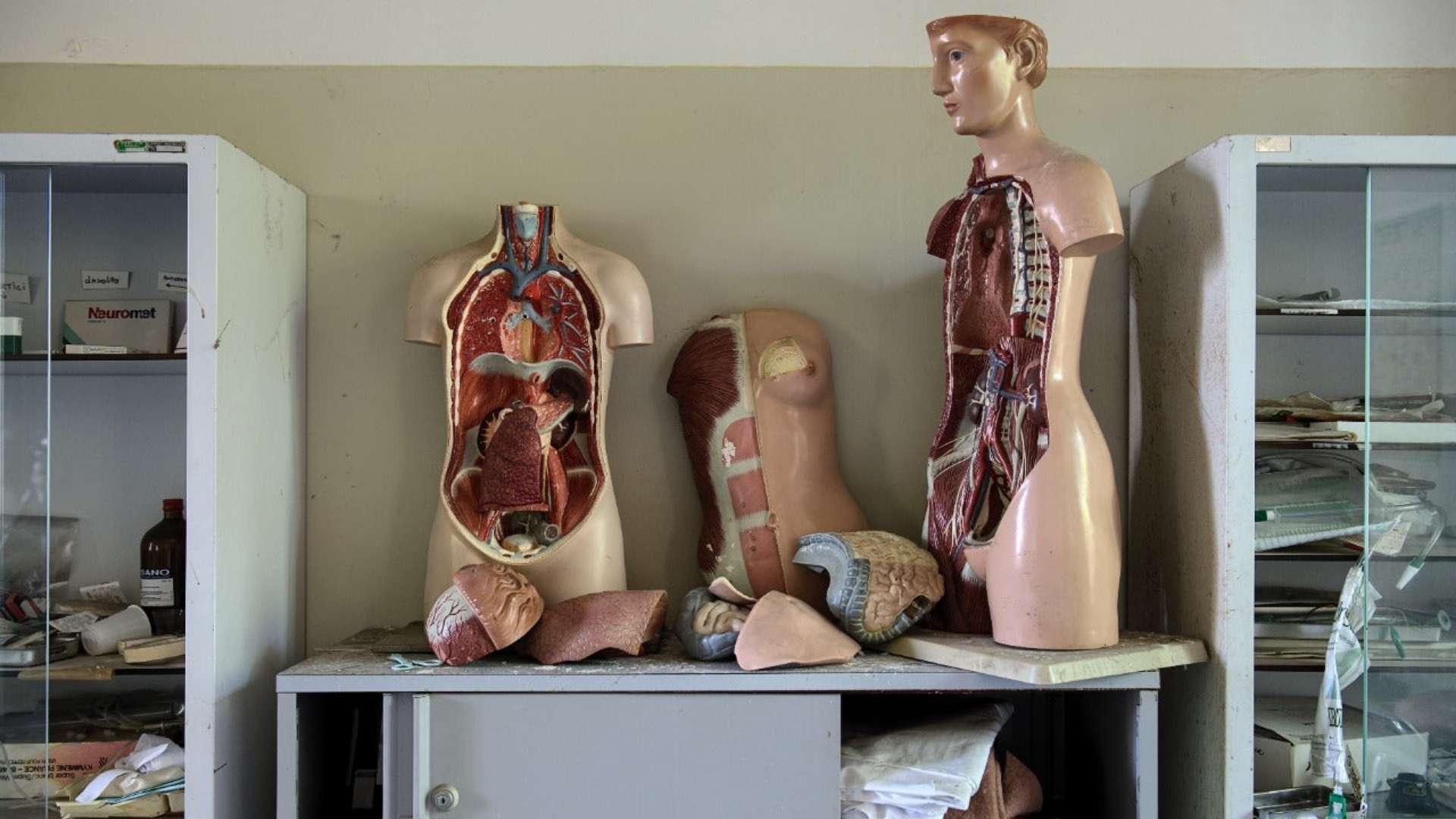 A medical room featuring a models depicting internal systems of a human body related to fatty liver