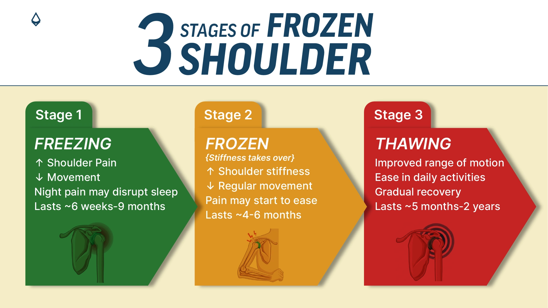 A blog infographic showing the three different stages of frozen shoulder
